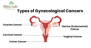 types of Gynecological Cancer in uae