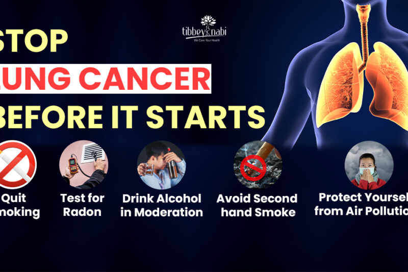 Stop Lung Cancer Before It Starts: 10 Prevention Tips That Work