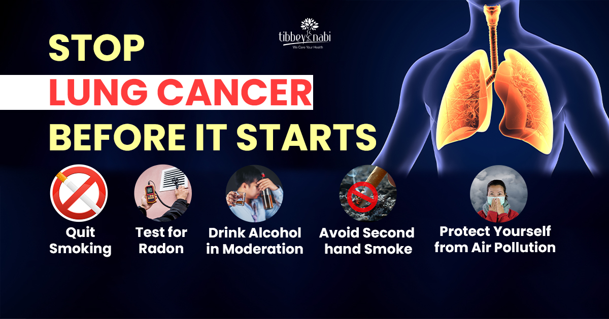 blog image tibbeynabi