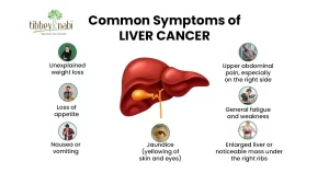common symptoms of liver cancer
