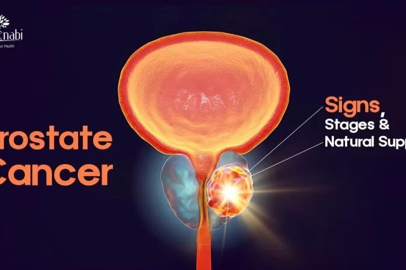 Prostate Cancer: Signs, Stages & Natural Support
