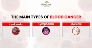 Blood Cancer Treatment How Immunotherapy helps