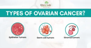 types of ovarian cancer